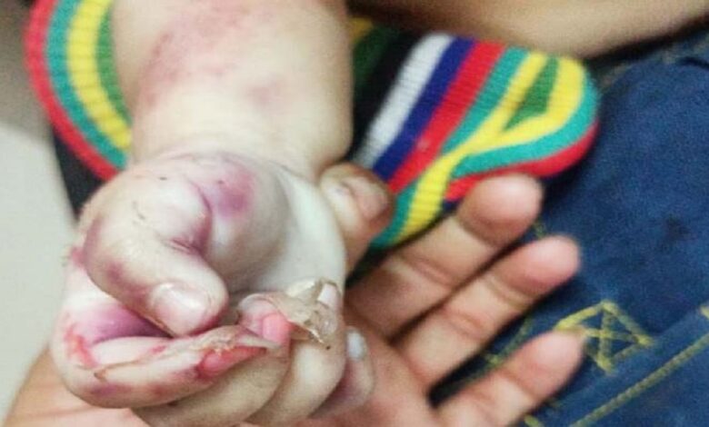 Bharuch's family was hit by an unknown vehicle, the child's skull was cut in two